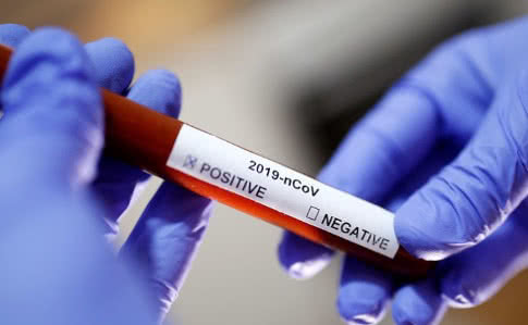 В Ужгороді за добу виявлено 57 випадків коронавірусної інфекції, 1 людина померла